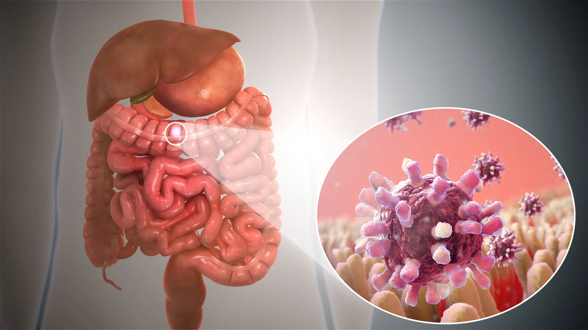 Gastrointestinal Disease
