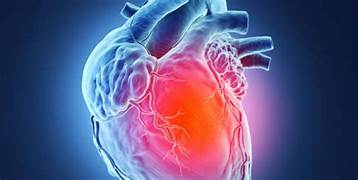 Heart Problems