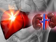 Liver Disease