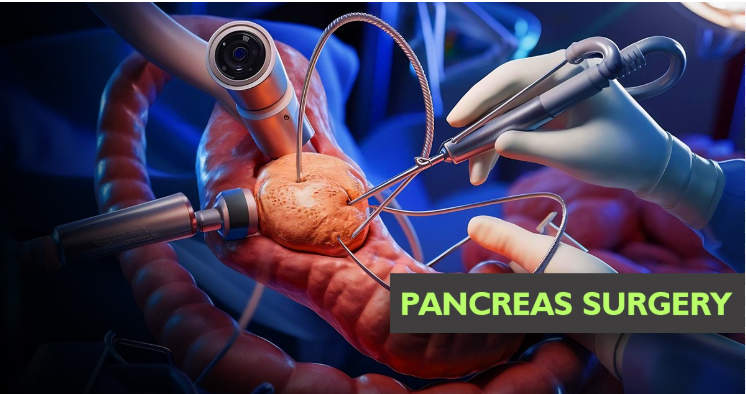 Pancreatic surgery procedure