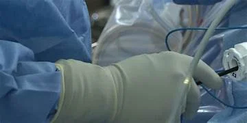Laser and Microwave Surgery